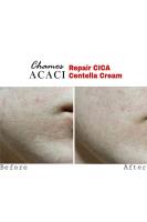 Chamos Repair Cica Centella Cream -akneli Ciltler Için Cilt Onarıcı ve Sakinleştirici Krem Nasıl kullanılır öğrenin ve  kullanıcı yorumlarına gözatın.