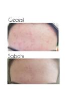 Chamos Repair Cica Centella Cream -akneli Ciltler Için Cilt Onarıcı ve Sakinleştirici Krem Nasıl kullanılır öğrenin ve  kullanıcı yorumlarına gözatın.