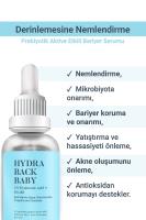 SHE VEC HYDRA BACK BABY | Prebiyotik Aktiviteli Derinlenmesine Nemlendirici Bariyer Serum Nasıl kullanılır öğrenin ve  kullanıcı yorumlarına gözatın.